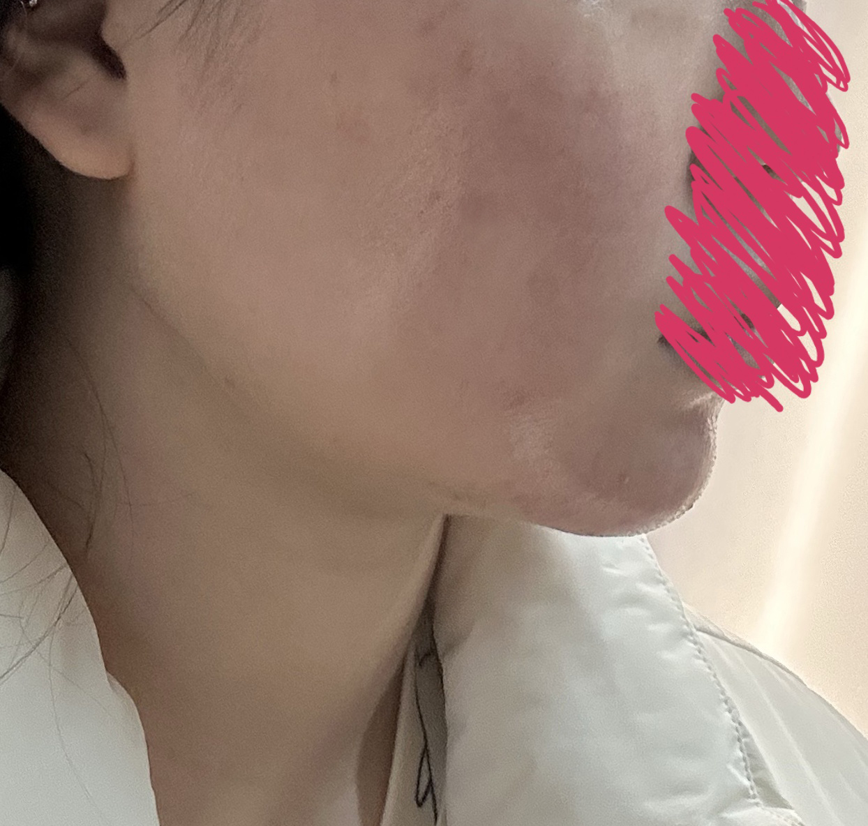 얼지흡후 이중턱이 없어졌어욧