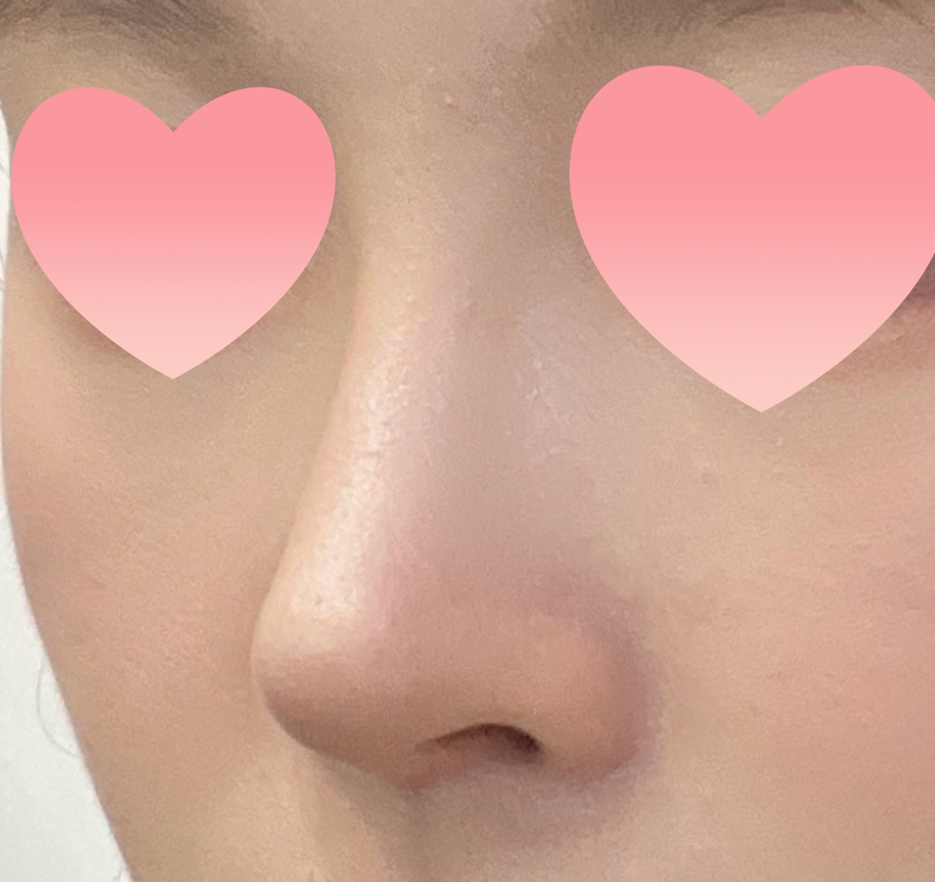 유원장님 믿고 수술 잘 된거같아요!