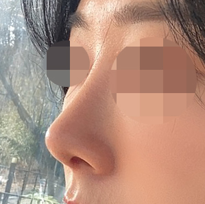 코성형은 바이브 유원장님입니닷!