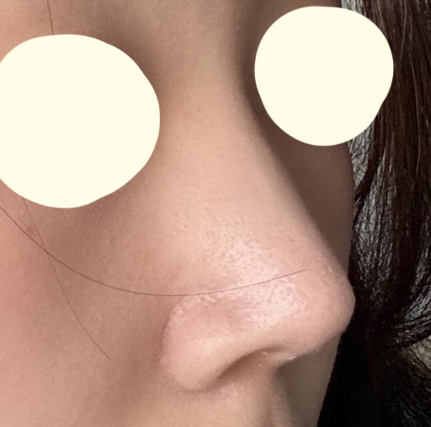 매부리 잘 다듬어졌어용