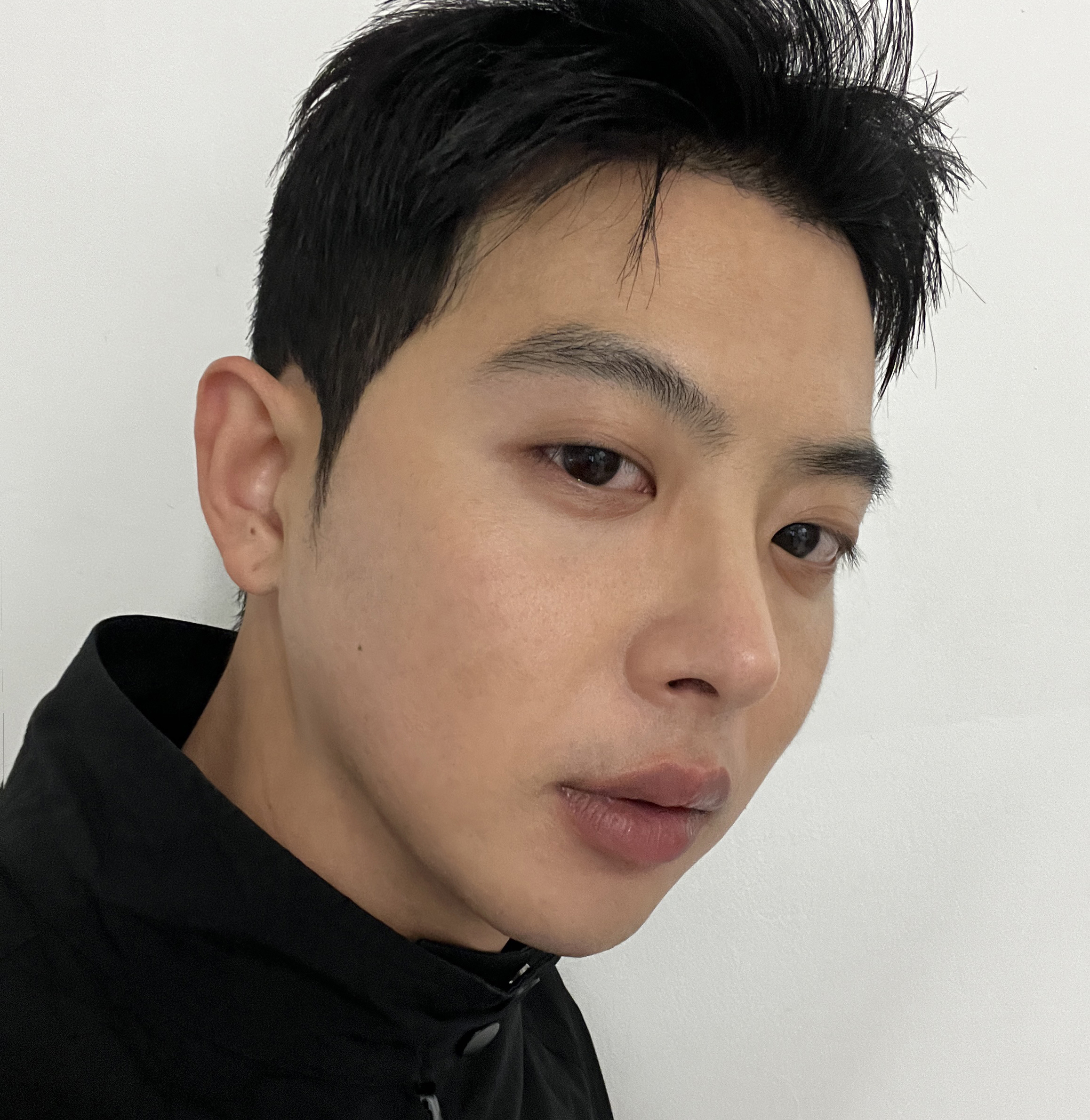 코, 이마축소술 12개월차 만족후기올립니다.