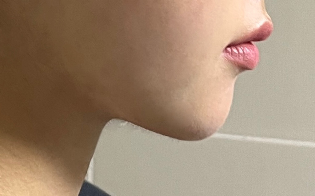 날렵한 턱선 만들어주셔서 감사합니다