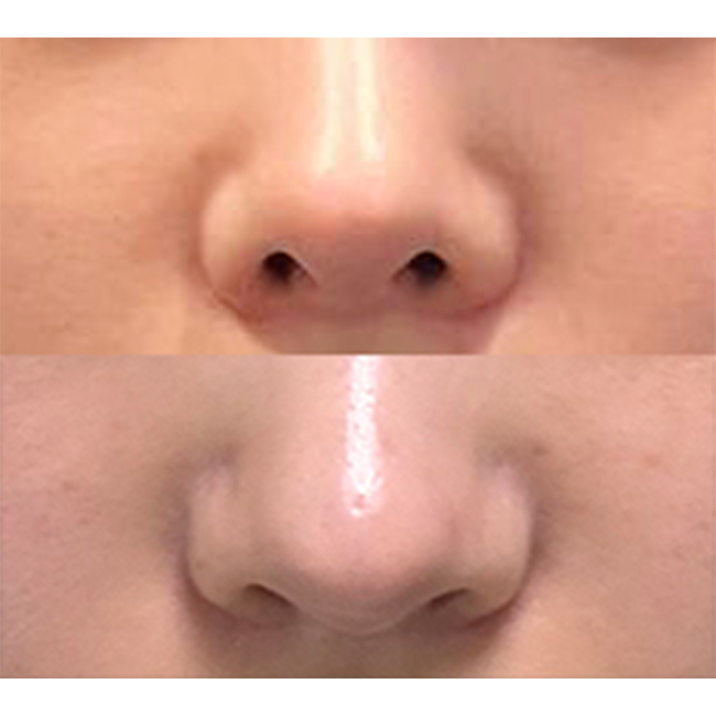 비공내리기 고민하면 바이브 적극추천ㅎㅎ