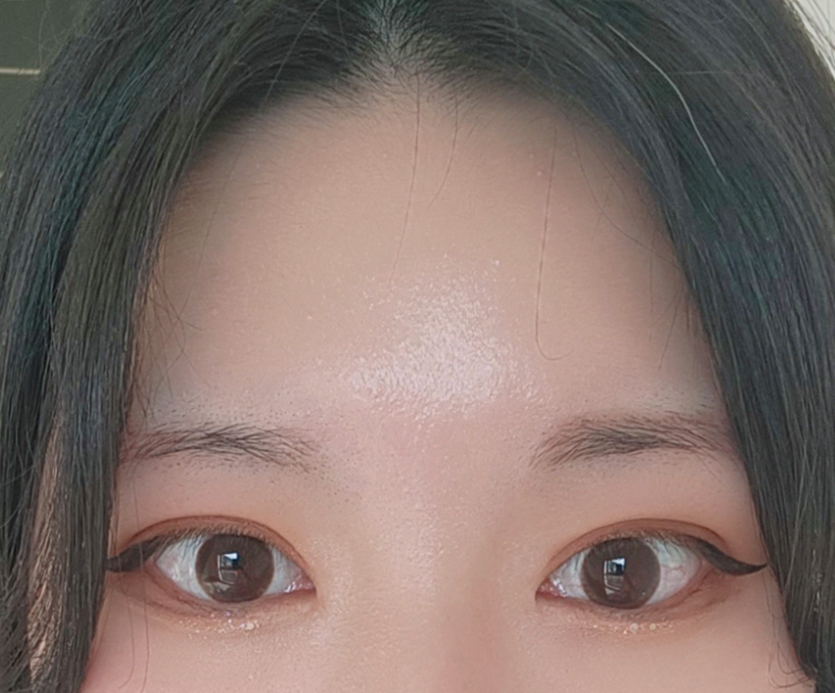 눈매가 또렷하고 시원하게 변했어요~~