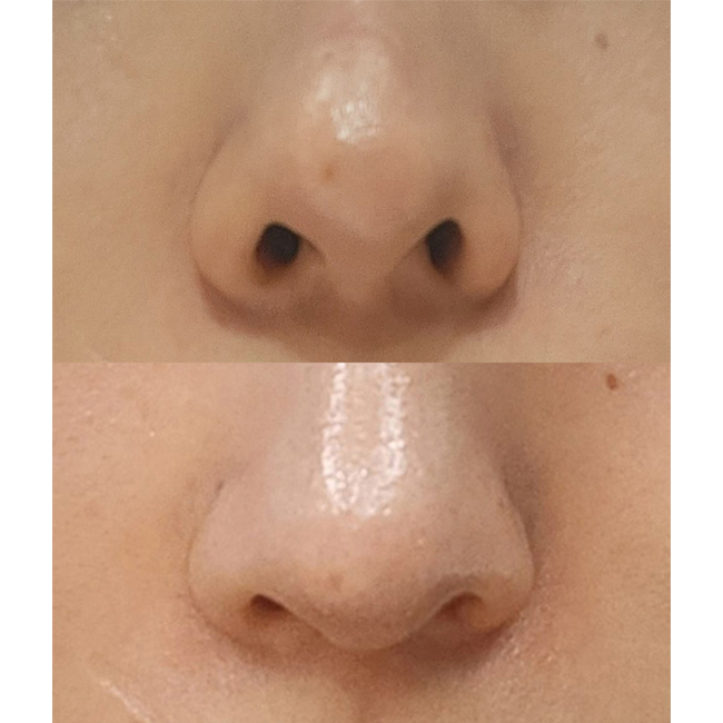 안하면 후회 했을거에요 ㅠ