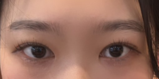 이게 제 눈이 맞나싶어요 ㅠㅠㅠ!! 감사합니다 원장님 !!