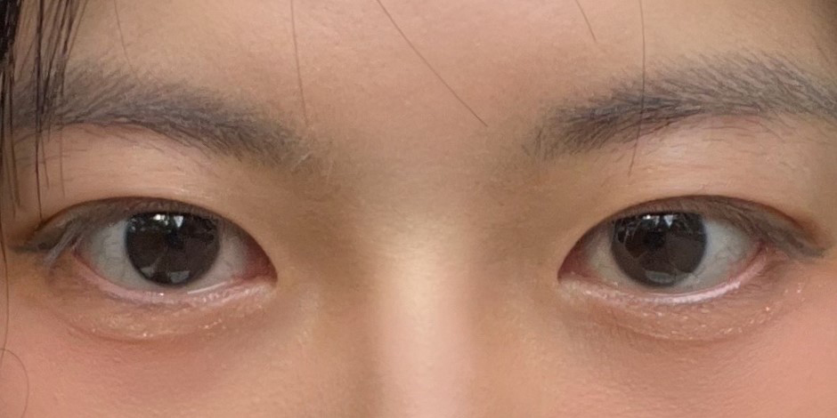 딱 제가 원하던 눈으로 만들어주셨어요!