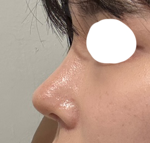 바이브에서 코, 얼지흡! 후회 ㄴㄴ요