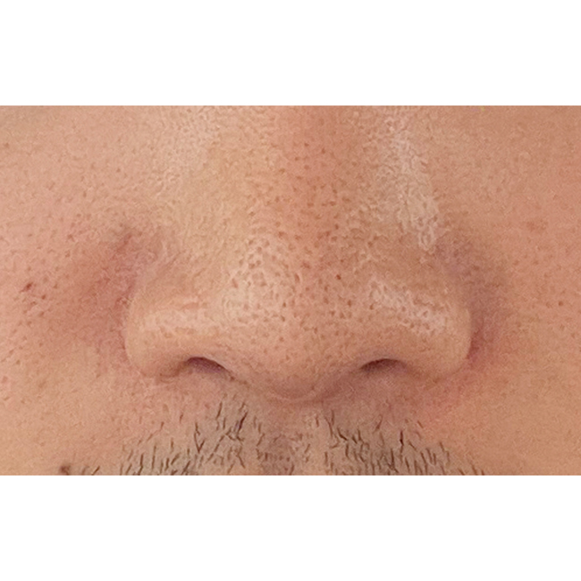 콧구멍짝짝이 맞춰져서 만족합니다.