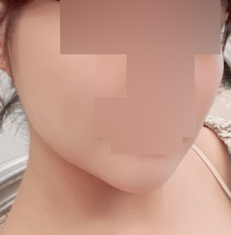 불독살, 이중턱 빠이빠이했어용