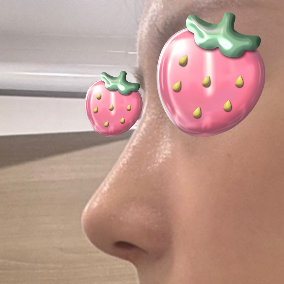 너무 만족하고 코도 자리 잘 잡았어용 감사합니다