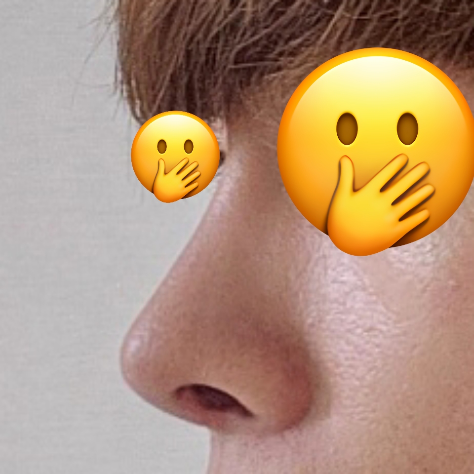 바이브 성형외과 정말 추천드리고 싶습니다