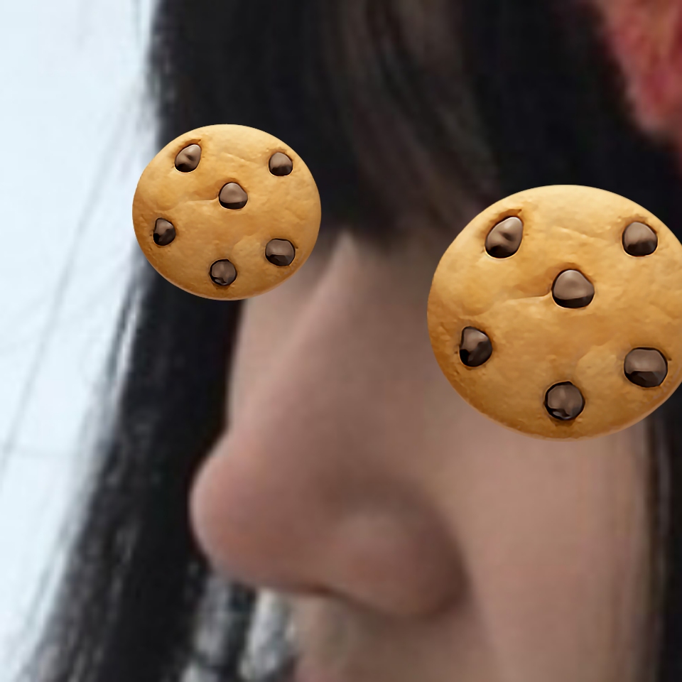 코수술한지 6개월 됐습니당 원장님 최고 !