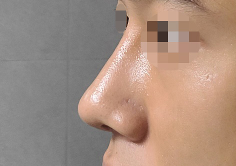 옆모습 보는 재미로 살고 있습니다..!