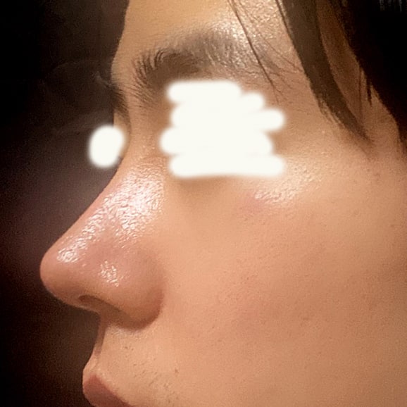 코가 남자다워졌어요ㅋㅋ