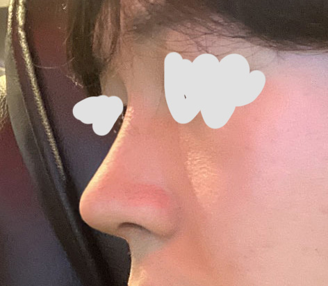 직선코로 원하는 모양대로 나왔어요