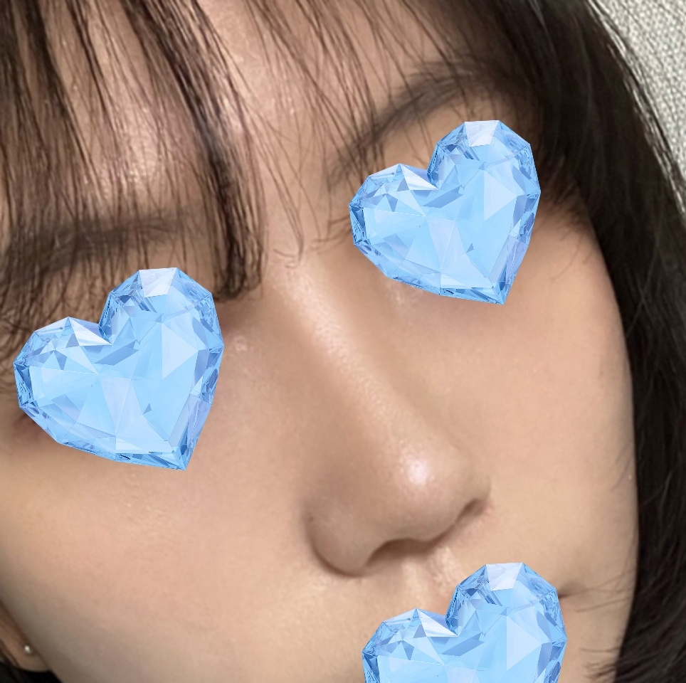 기능적, 미용적 모두 굿 ㅎㅎ