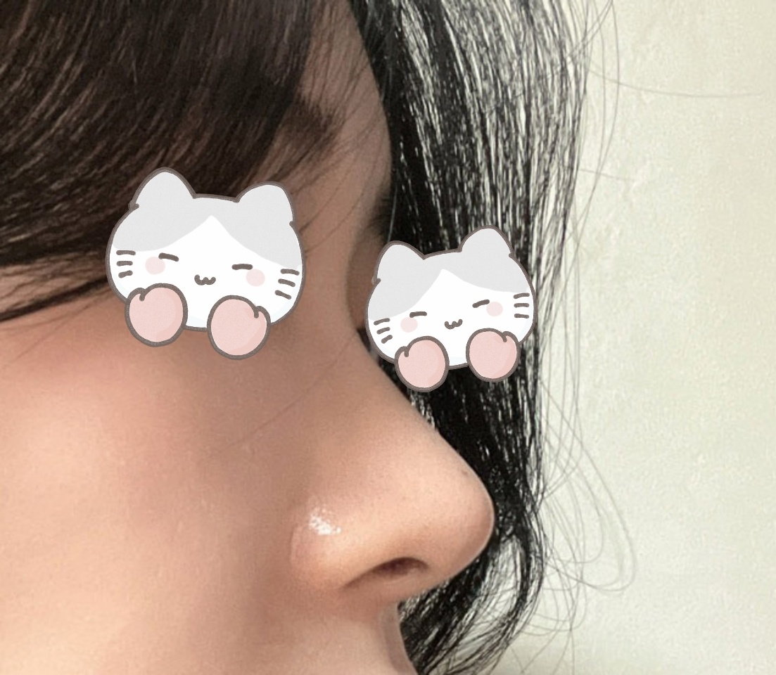 무보형물로 코했슴당