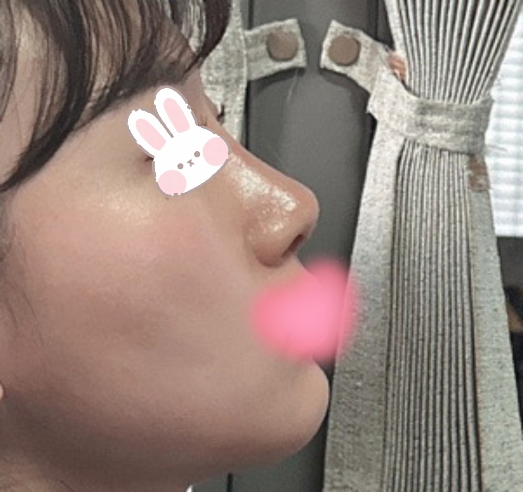 복코교정 잘됐쥬?