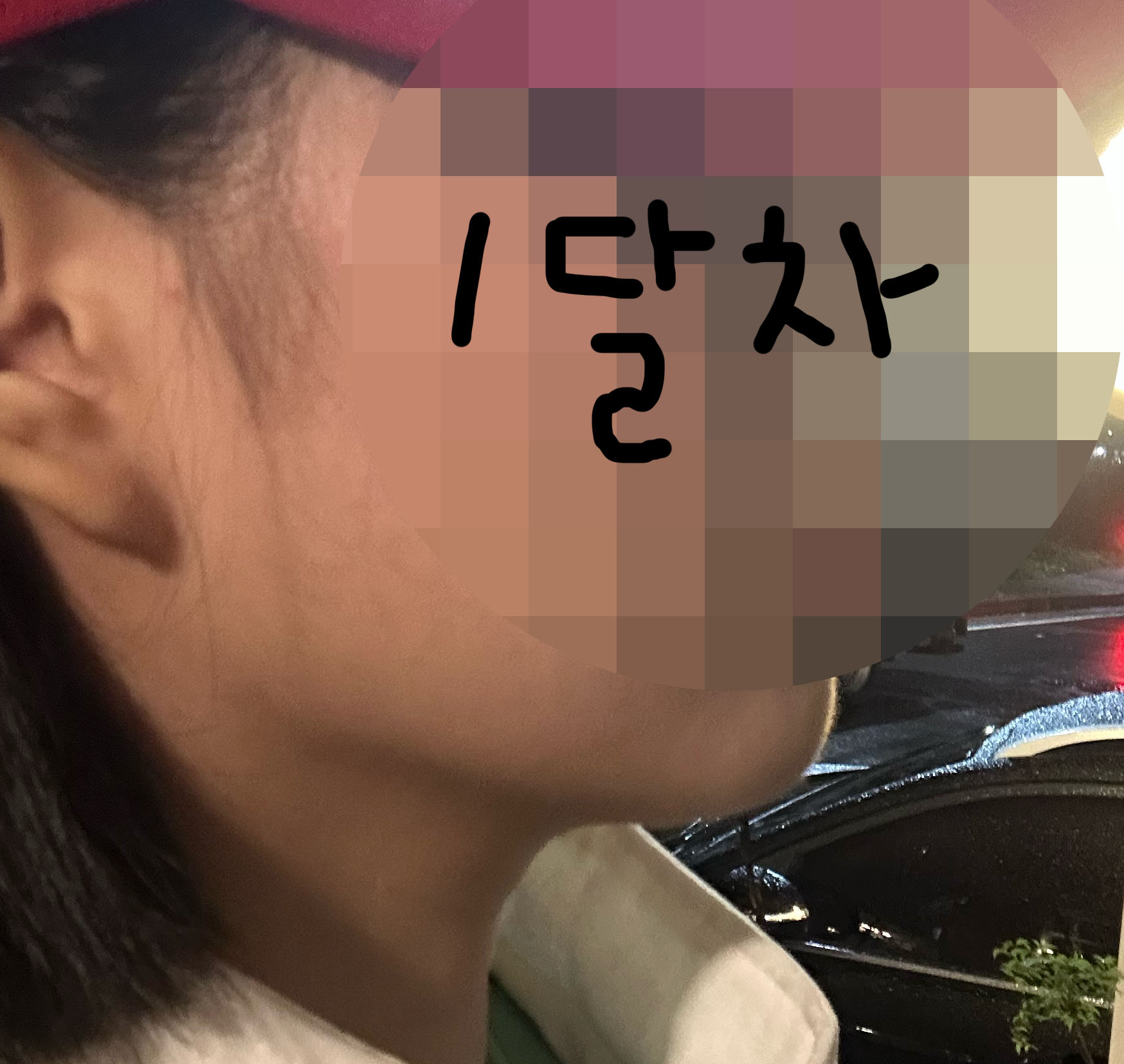 유원장님이 지방 꼼꼼하게 빼주셨어요 ㅎㅎ