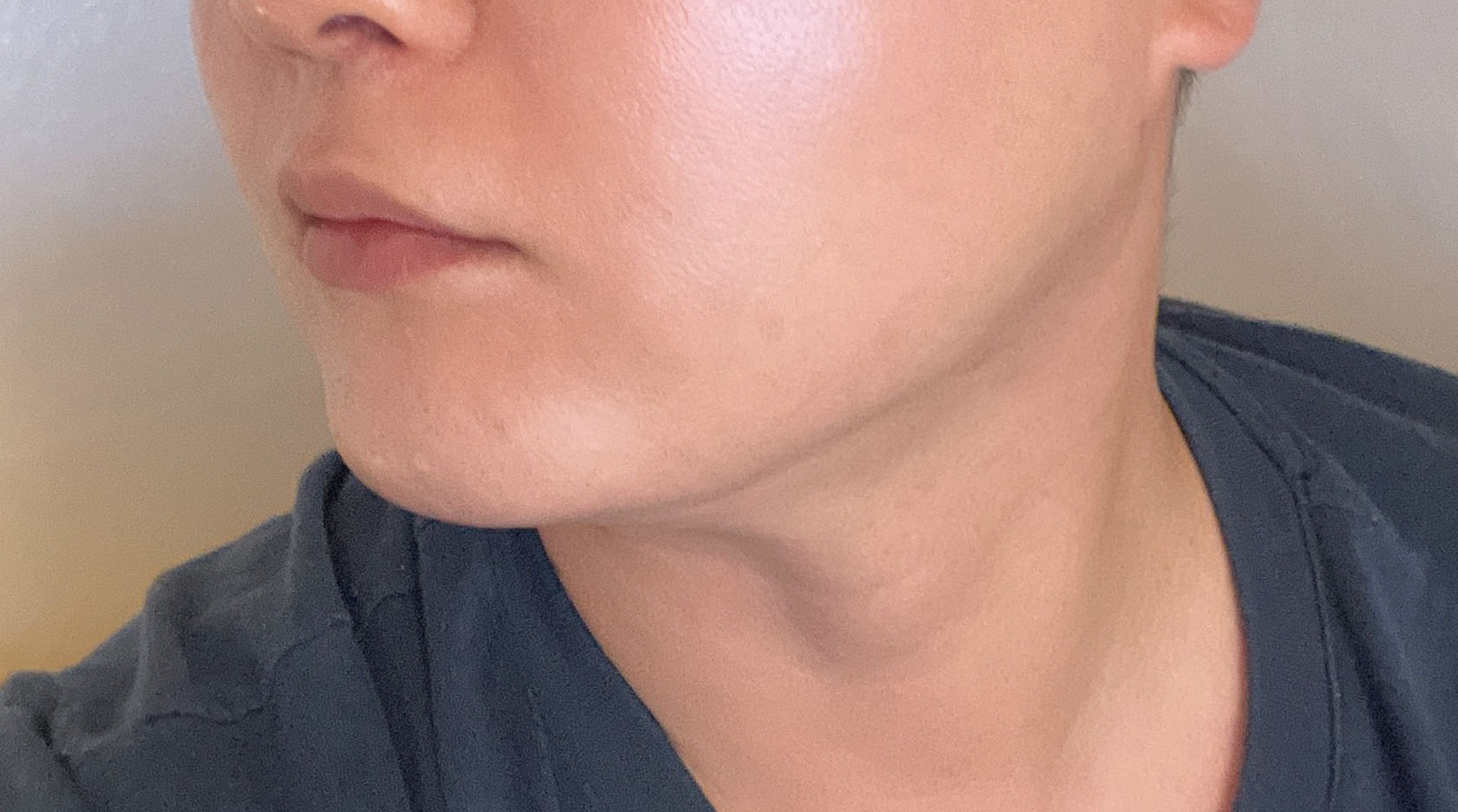 나날이 갸름해지는 턱라인 너무 만족해요