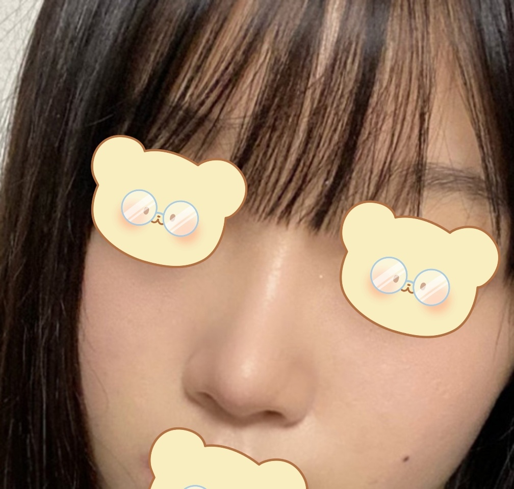 복코교정 6개월차 ㅎ.ㅎ