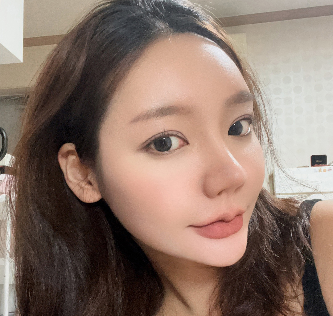 코3번째수술과 눈성형을 유원장님께 맡겼습니다:)