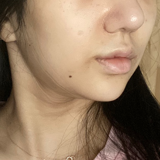 이중턱+볼살 스트레스 해결!