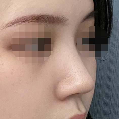 반년인데 코끝 처짐도 없고 좋아요