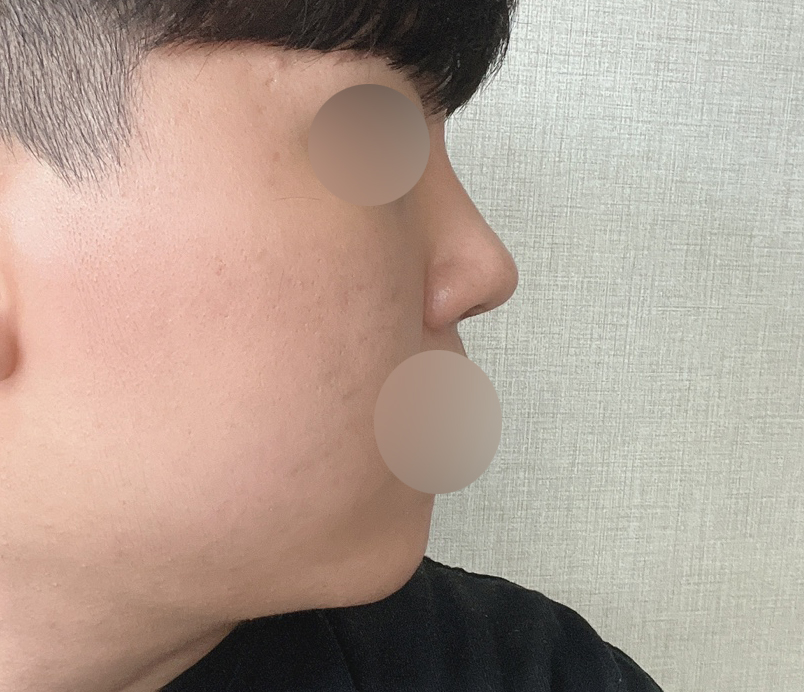 자연스럽게 잘 됐습니다.