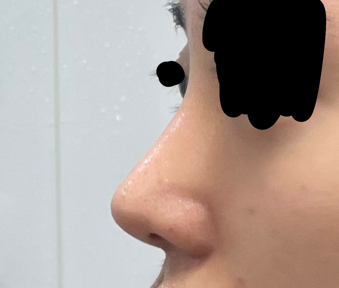 고민끝에 결정한 바이브 후회없어용