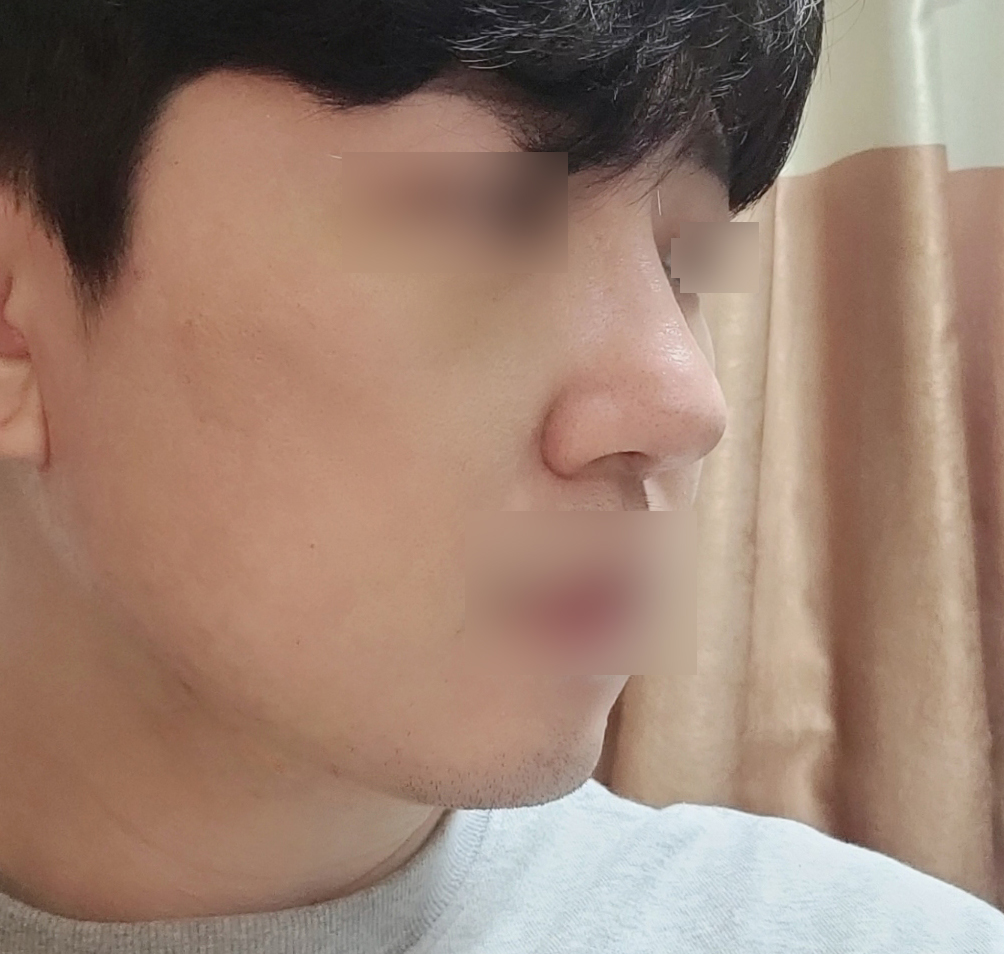 지인들에게 코, 지방흡입맛집이라고 추천하고싶어요