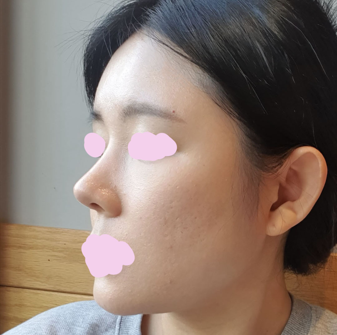 유영문원장님 실력 완전 쵝오!