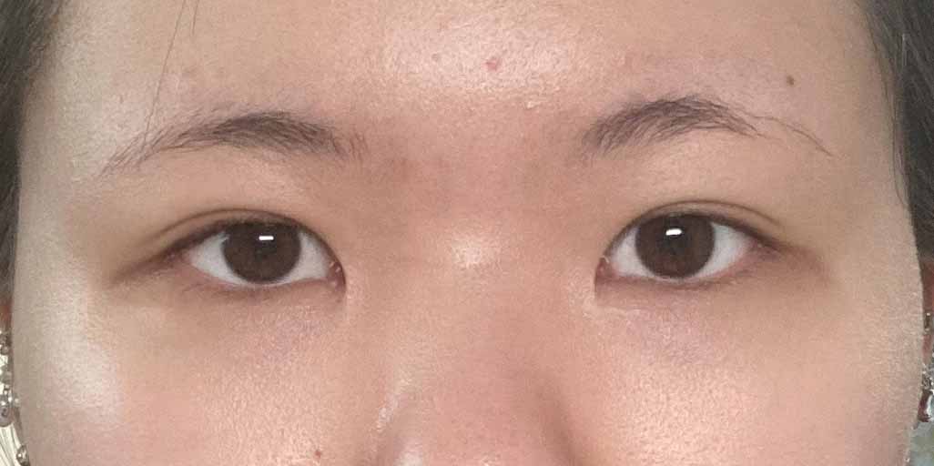 눈 하길 잘했어요 ㅎㅎ