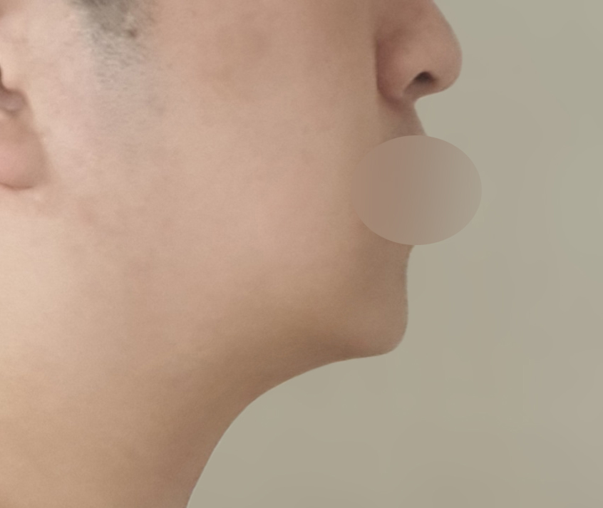 남자 얼굴지흡 바이브에서 하세요!