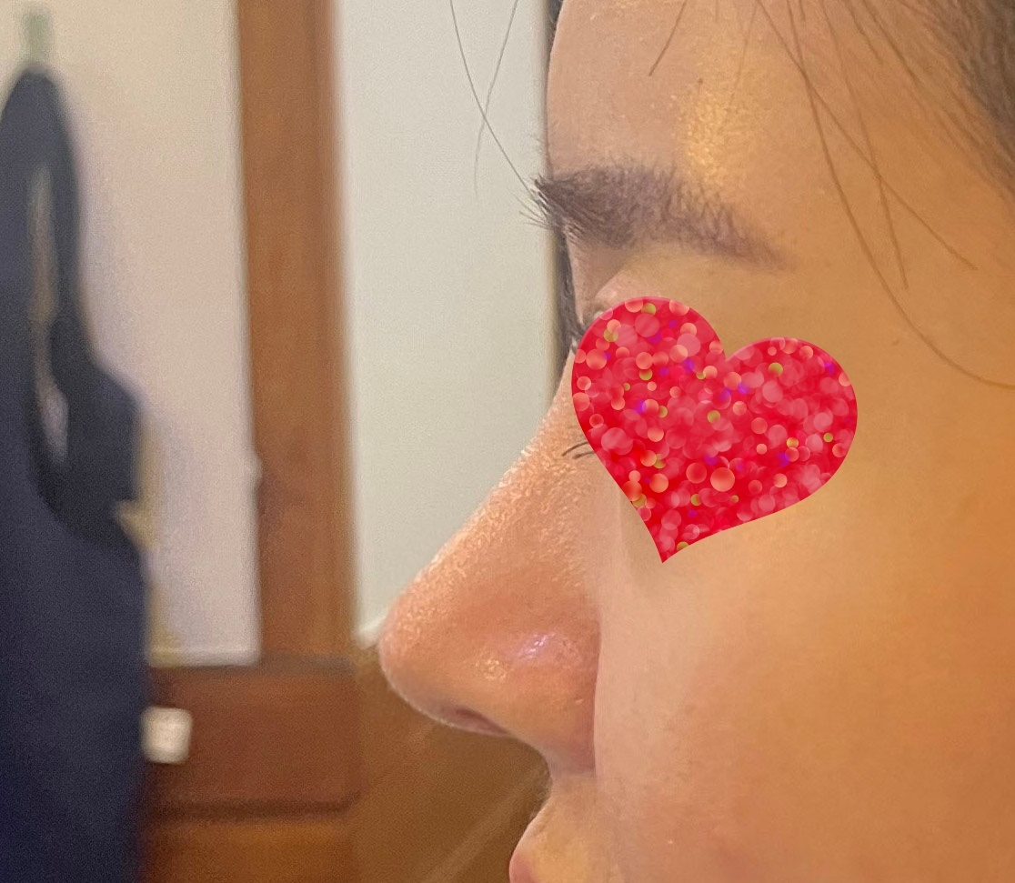 주변에서 코어디서했냐구 물어봐요ㅎㅎ