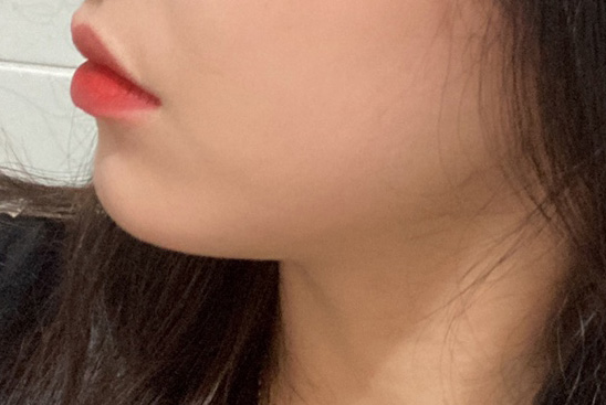 이중턱 라인 정리 성공!!