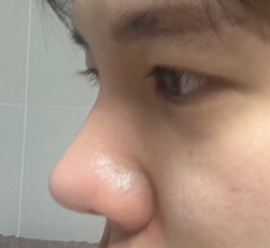 남자성형 바이브 적.극.추.천!