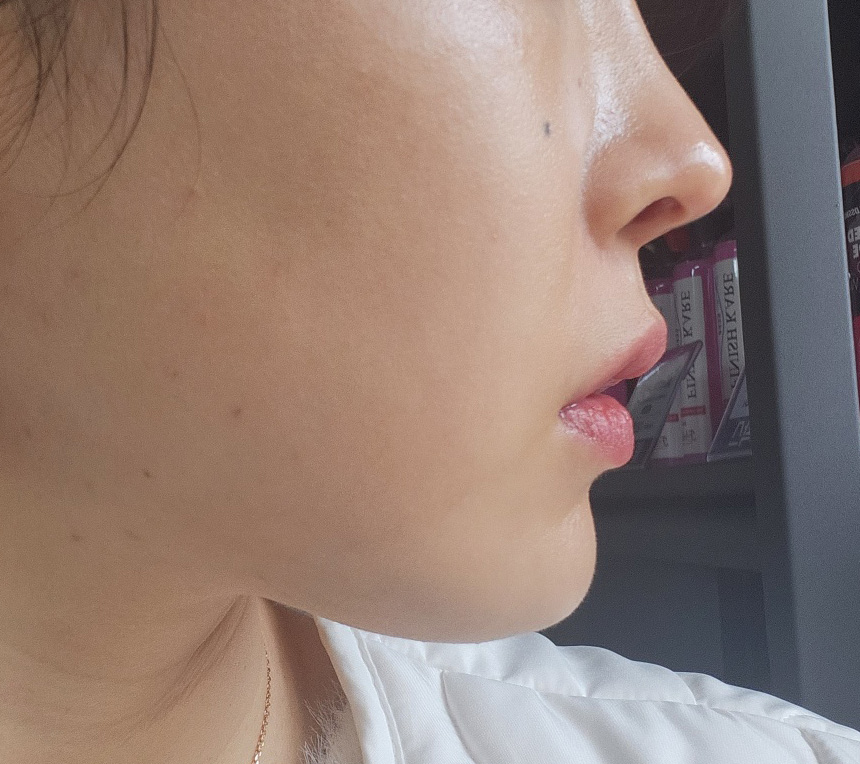 바이브에서 얼지흡하길 잘한거같아용 후후