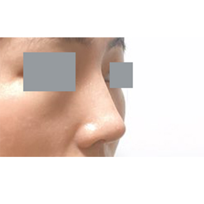 눈, 코 만족해서 후기적어요~