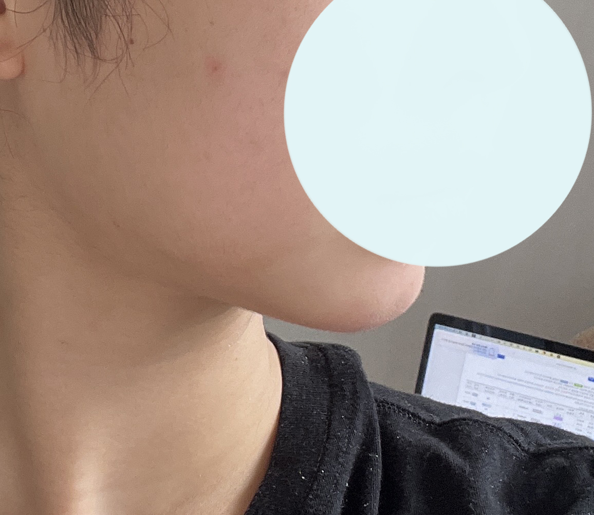 이중턱살 쏘-옥 빠졌어욤