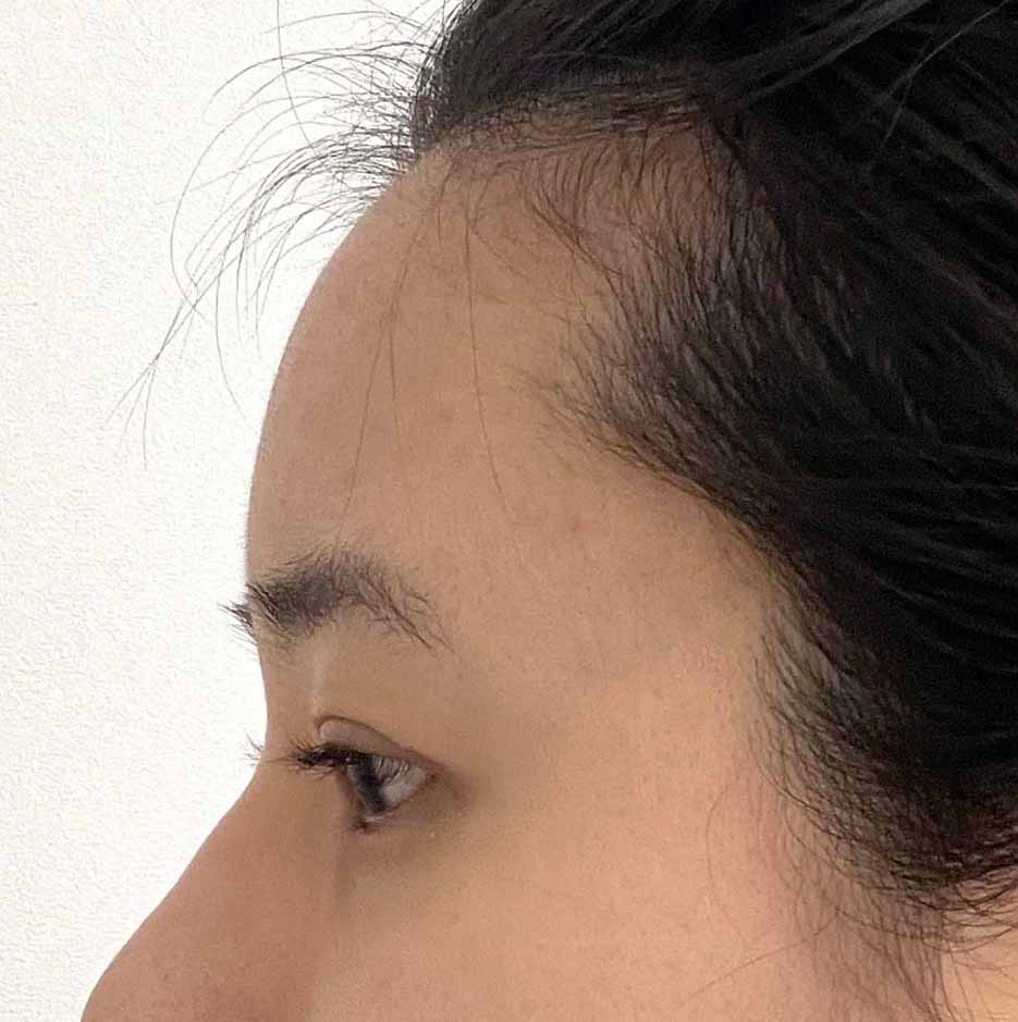 바이브에서 수술한 모든게 만족스러움