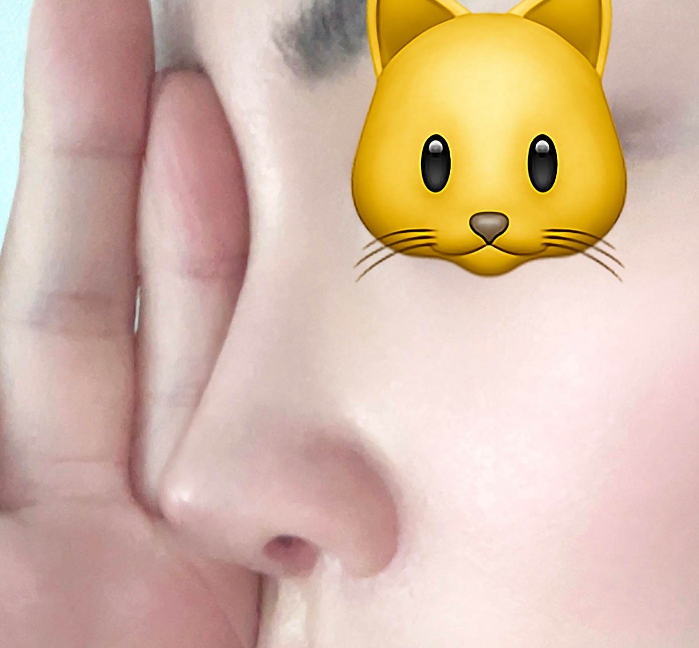 17년전 첫코하고 다시 재수술했습니다:)만족~