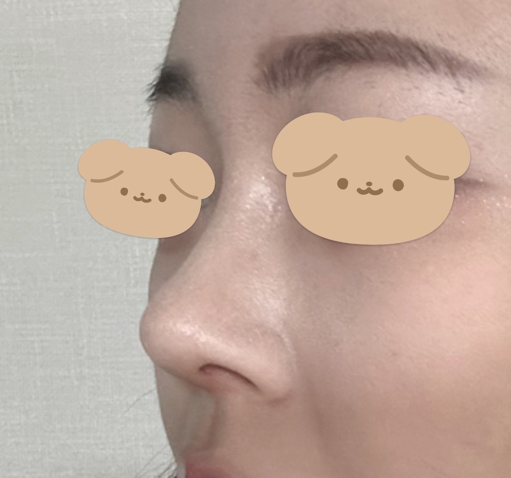 하루하루 거울볼때마다 만족 백퍼!