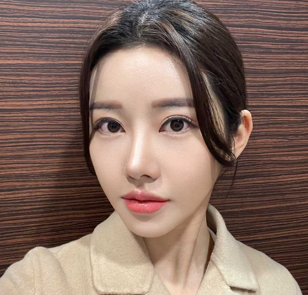 펑퍼짐했던 복코, 얄쌍해진 후기!