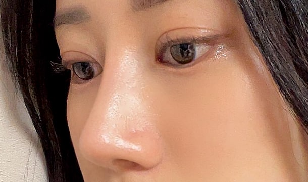 눈재코재 하실꺼면 여기서하세요ㅎㅎ