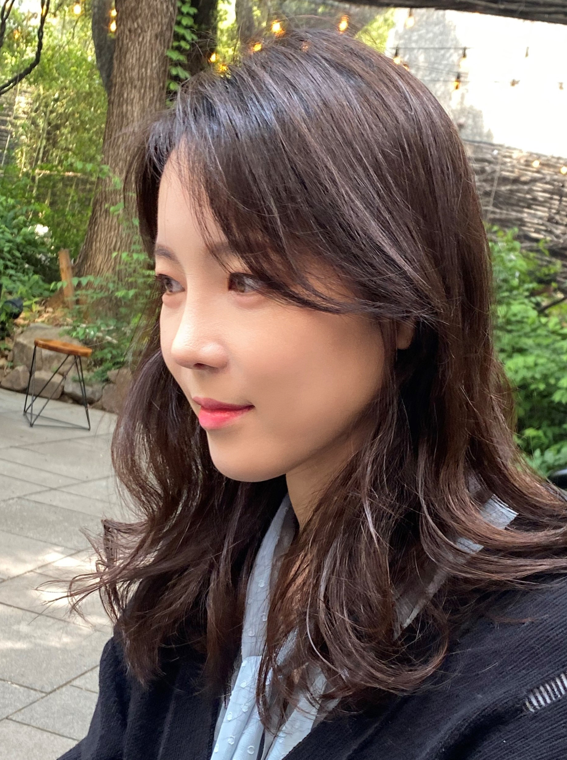 코재수술 한달후기!