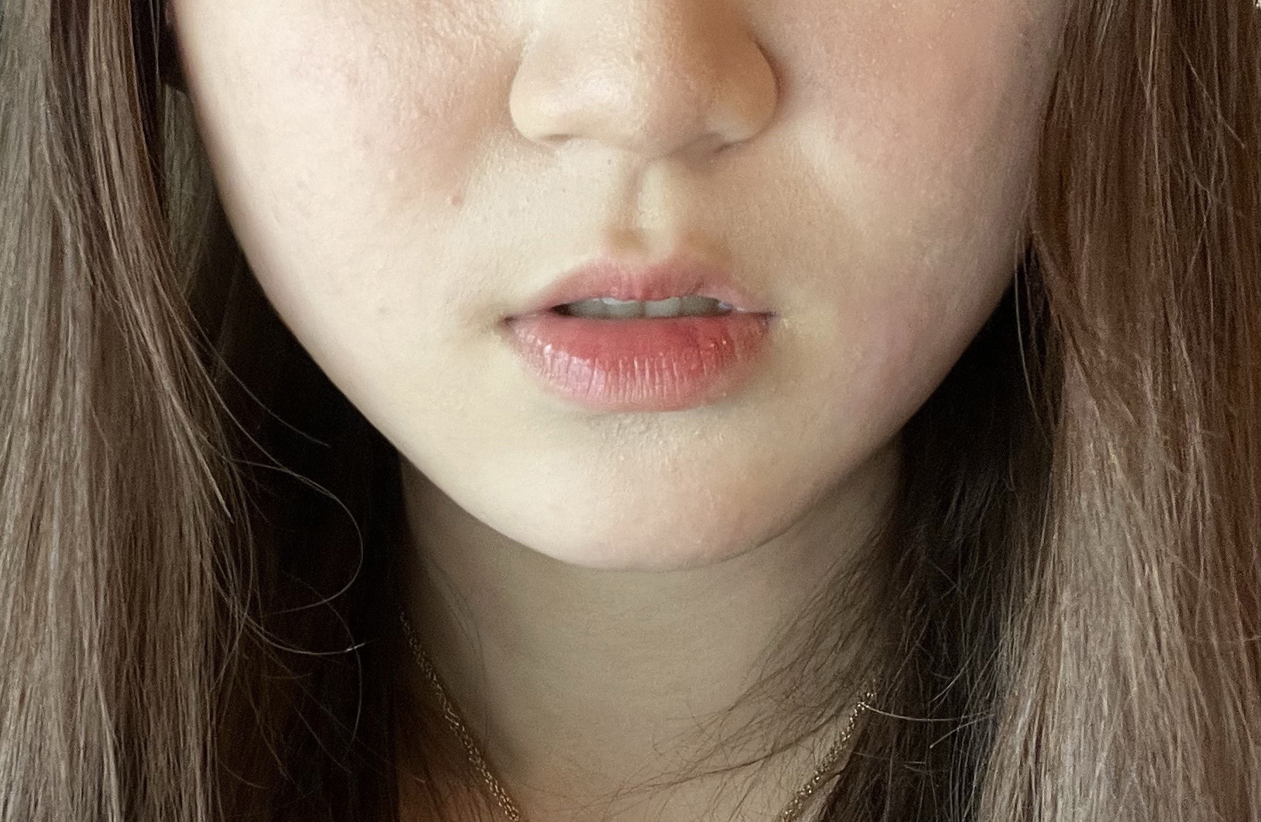 바이브 얼굴지흡 최고에요ㅠㅠ