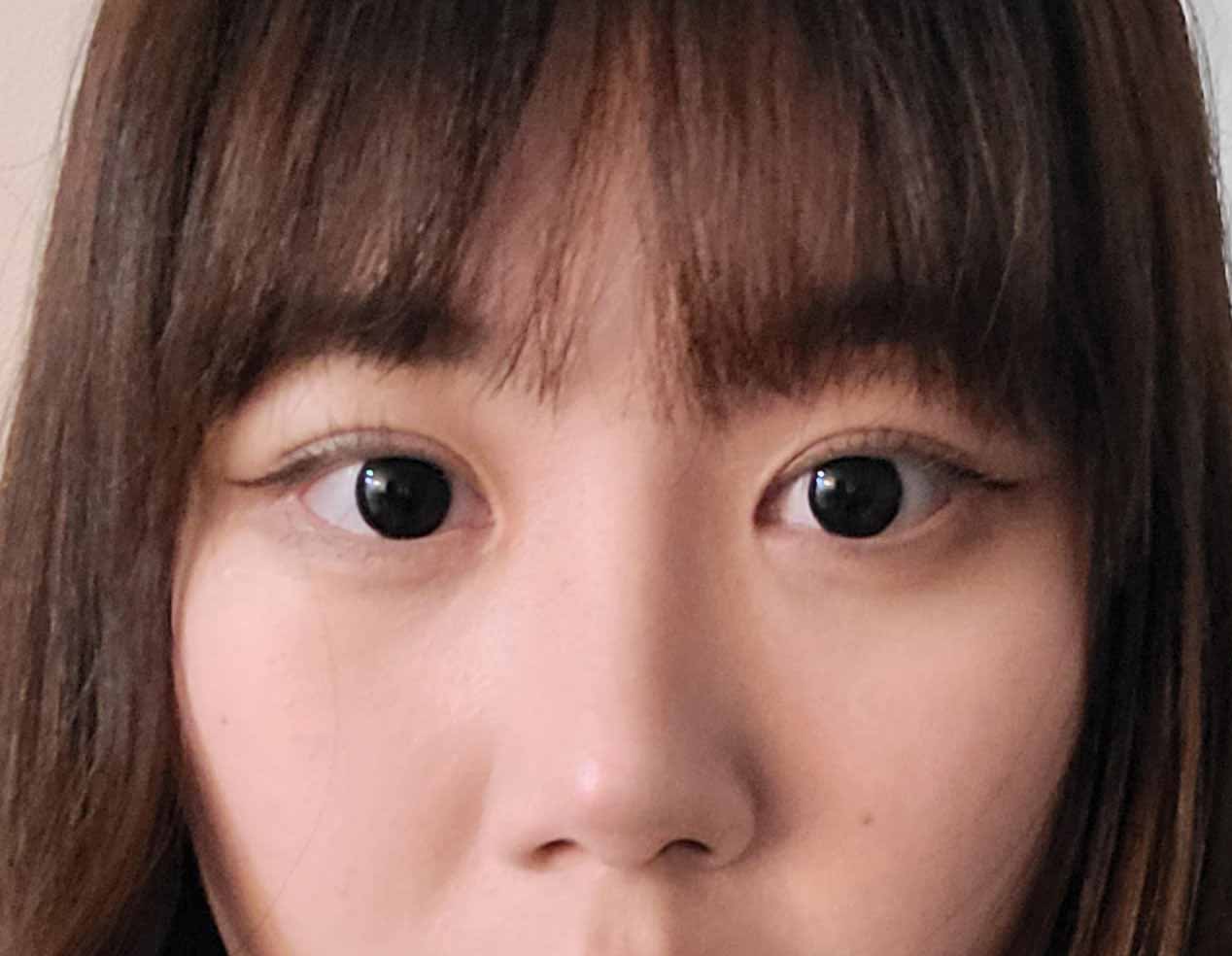 눈 코 성형 모두 대만족이에요^.<