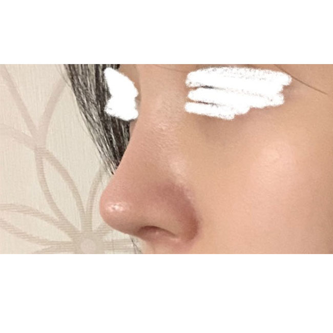 눈, 코한지 벌써 4갤차!